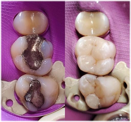 FullDent